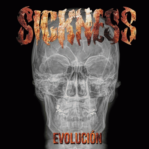 Sickness (MEX) : Evolución